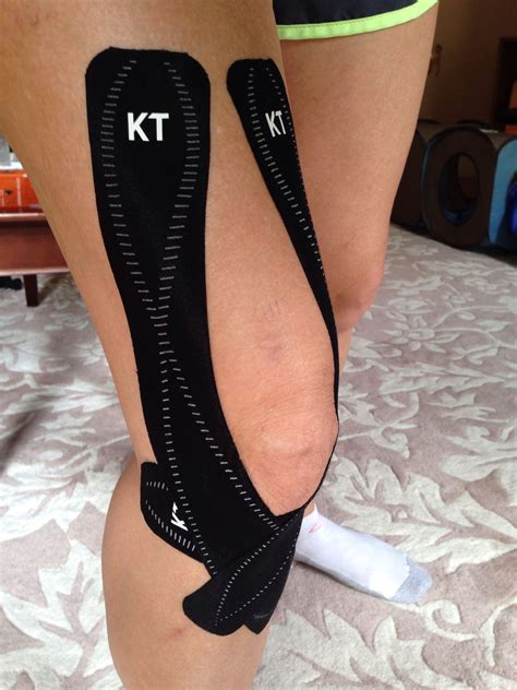 Hinman RS, Crossley KM, McConnell J, et al. Efficacy of knee tape in the management of osteoarthritis of the knee: blinded randomised controlled trial. BMJ. 2003;327(7407):135.
